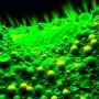 Для боротьби з раком підшлункової залози сконструйовано нове антитіло
