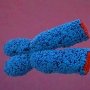 Короткие теломеры связаны с интерстициальным заболеванием легких при ревматоидном артрите
