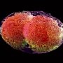 Обезьянья оспа – вторая «корона»? Roche представила сразу три ПЦР-теста для выявления новой инфекции
