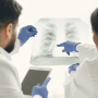 Препарат AstraZeneca від раку легень не показав суттєвого поліпшення загальної виживаності /freepik