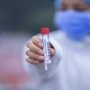 коронавірус covid-19 /medicover