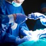 Українські хірурги вперше застосували LECS: інноваційну методику видалення пухлин шлунку /freepik