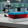 В Україні посилюють систему крові за рекомендаціями Рахункової палати /freepik